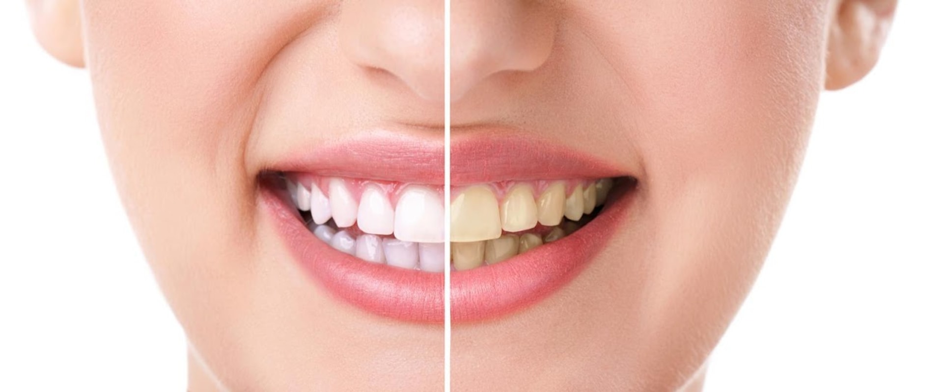 Elevate Your Oral Health with Radiant Dentistry