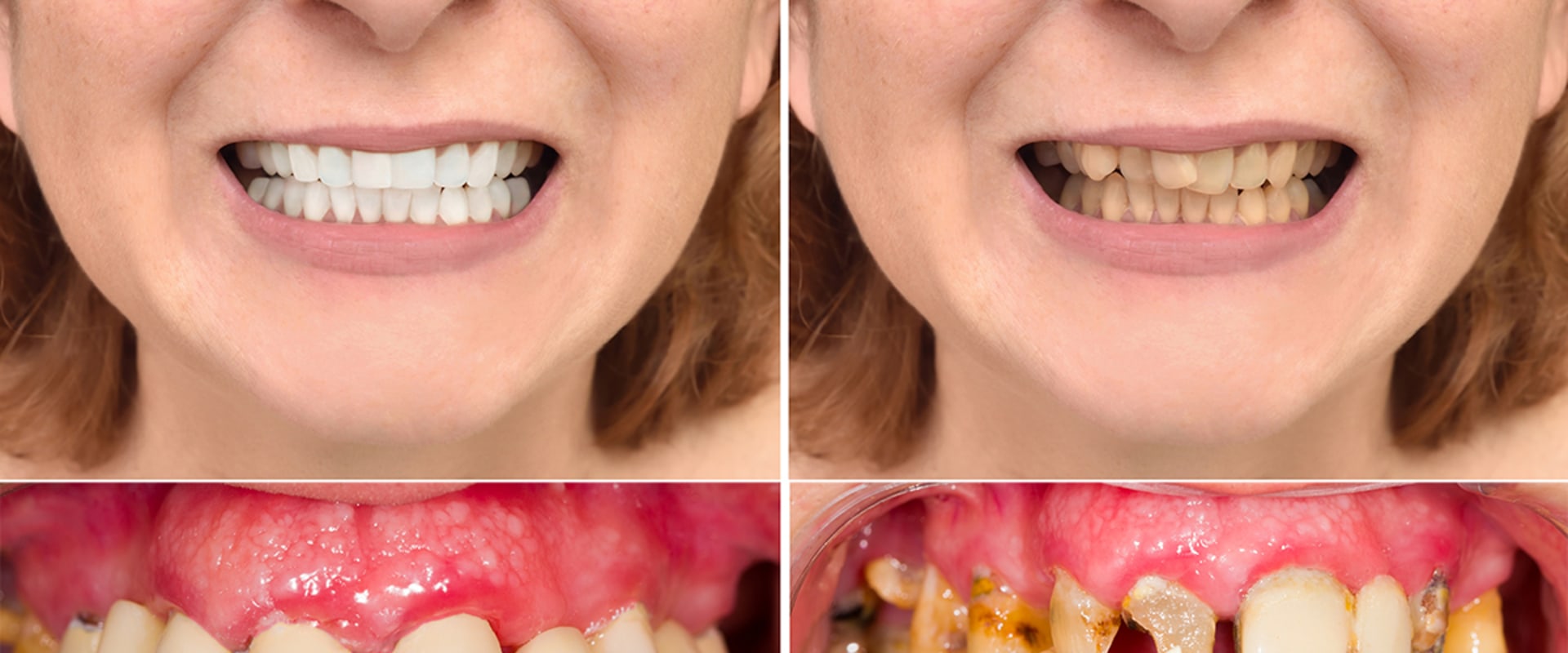 How do you make your teeth look perfect?