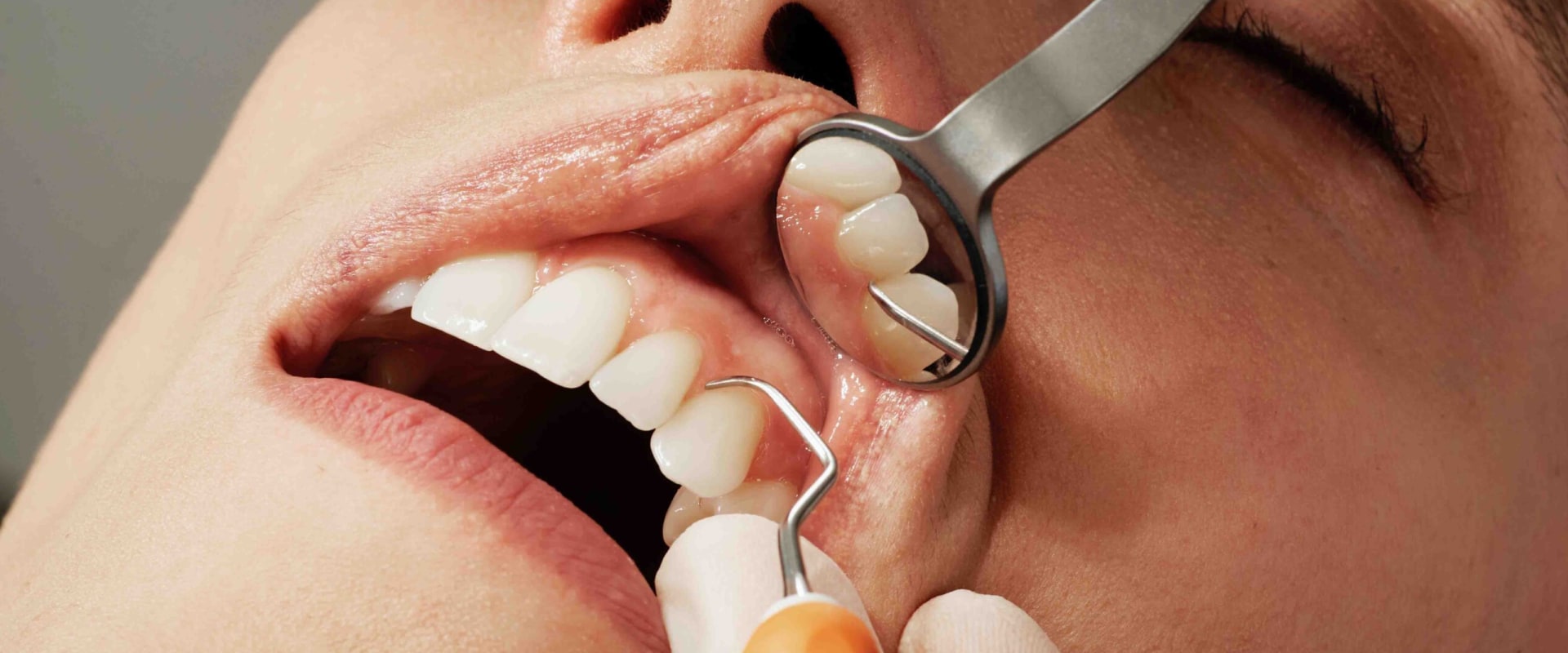 What are the different types of cosmetic dentistry?