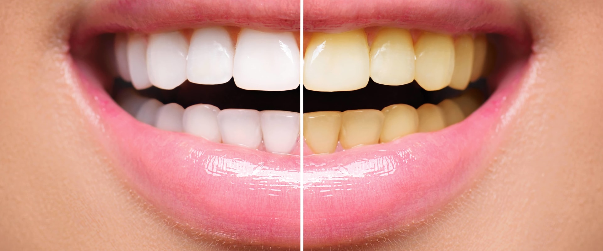 What is cosmetic dentistry treatment?
