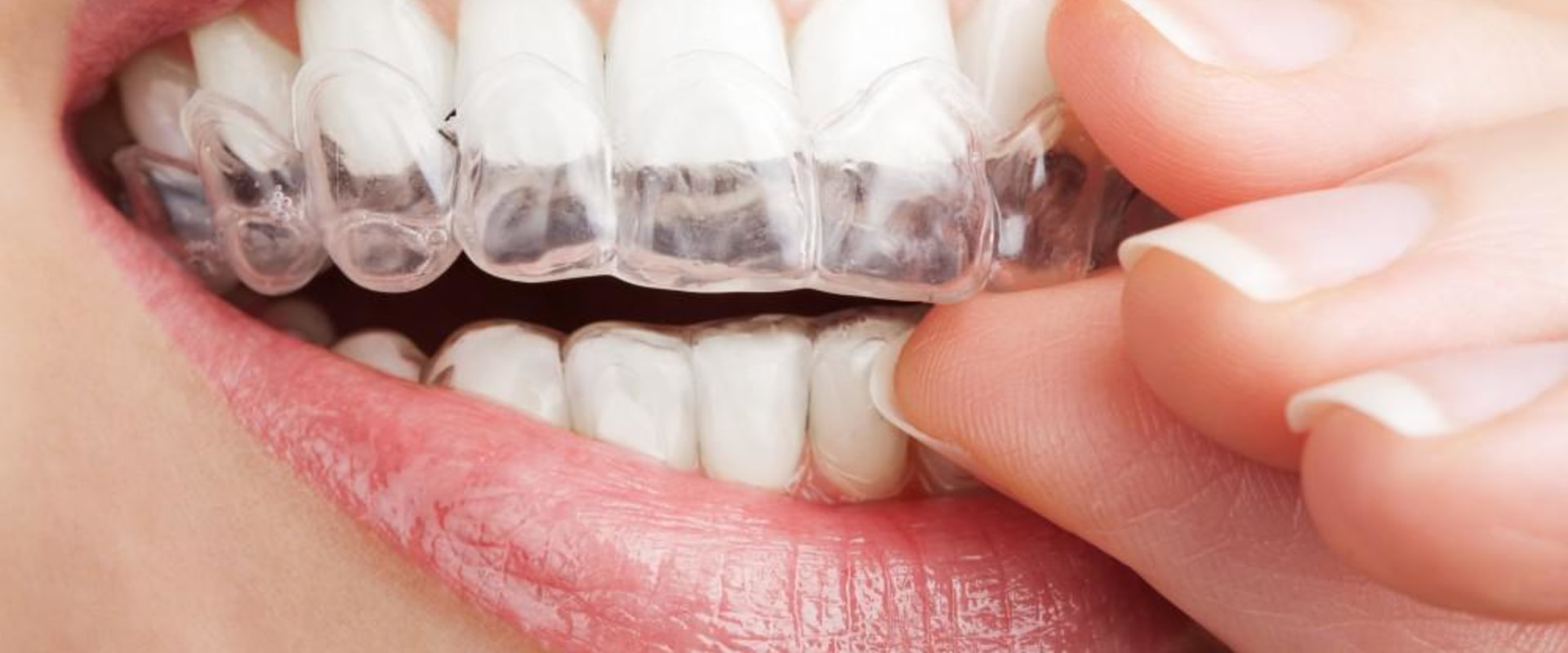 10 Common General Dentistry Services Provided By A Dentist In San Antonio