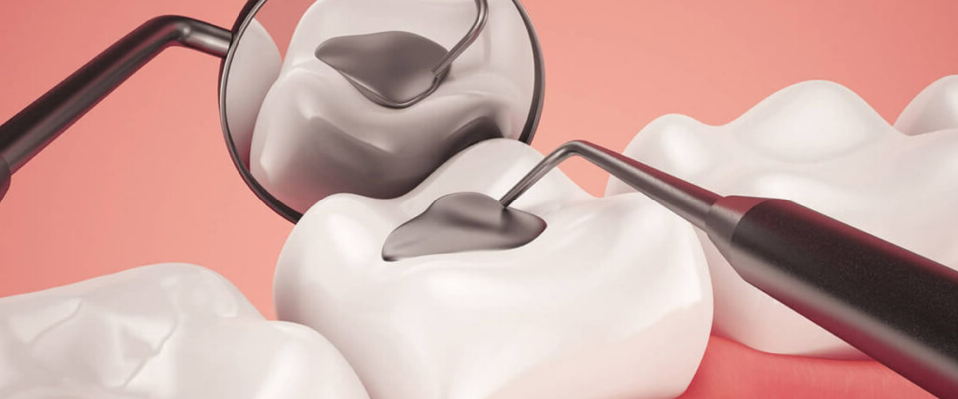 What type of service is fillings?