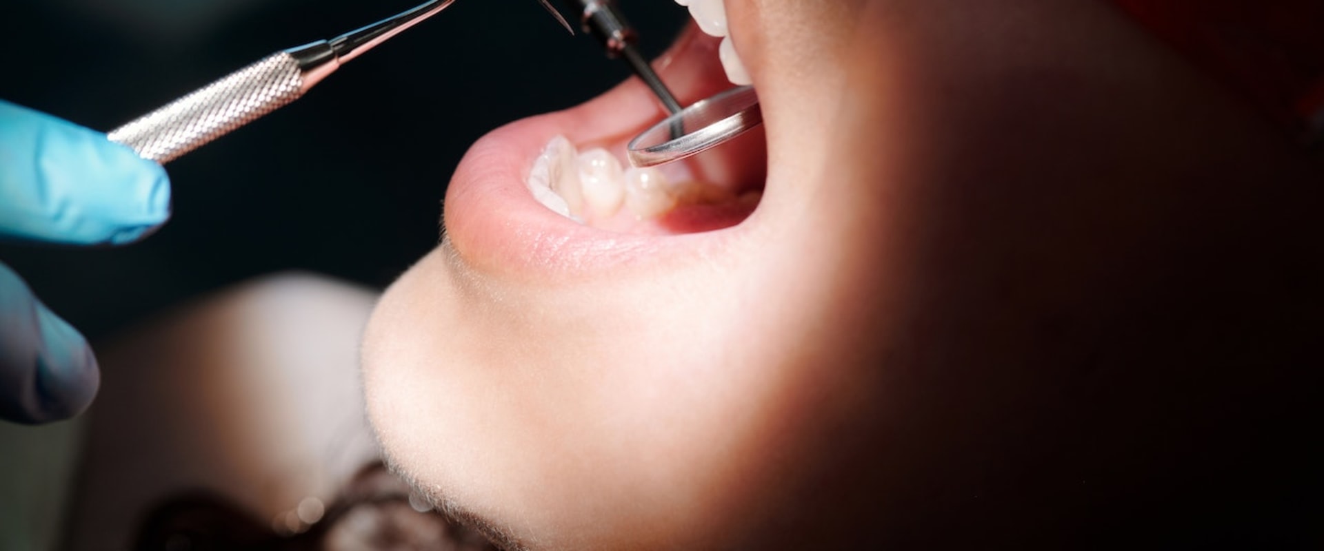 Protecting Your Smile: The Role Of General Dentistry In Managing Gum Disease In Sydney