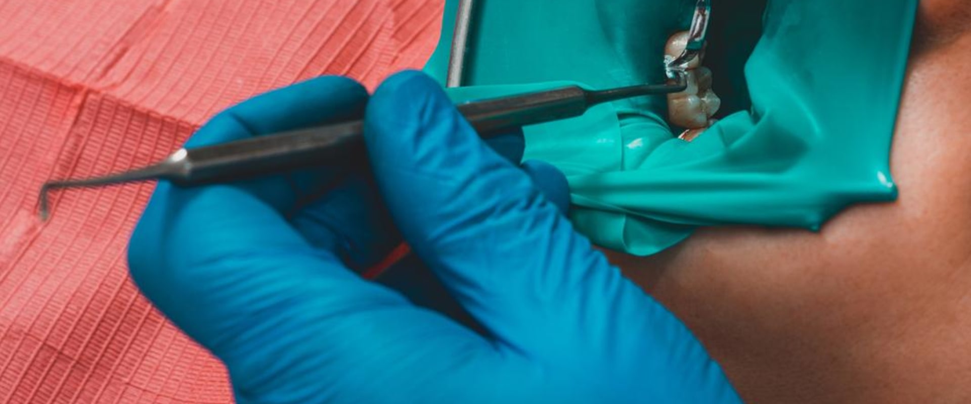 General Dentistry In London: What You Need To Know About Invisible Dental Fillings