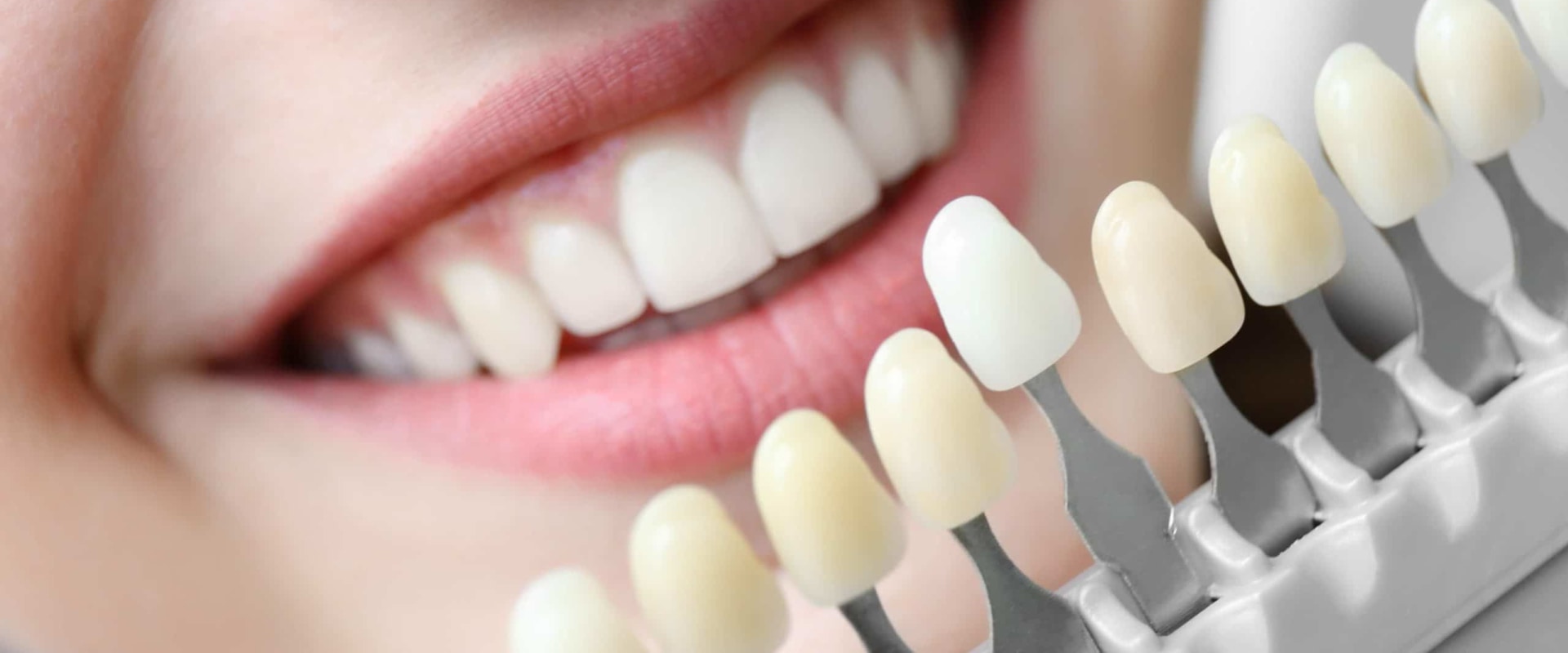 What are the best teeth restoration?