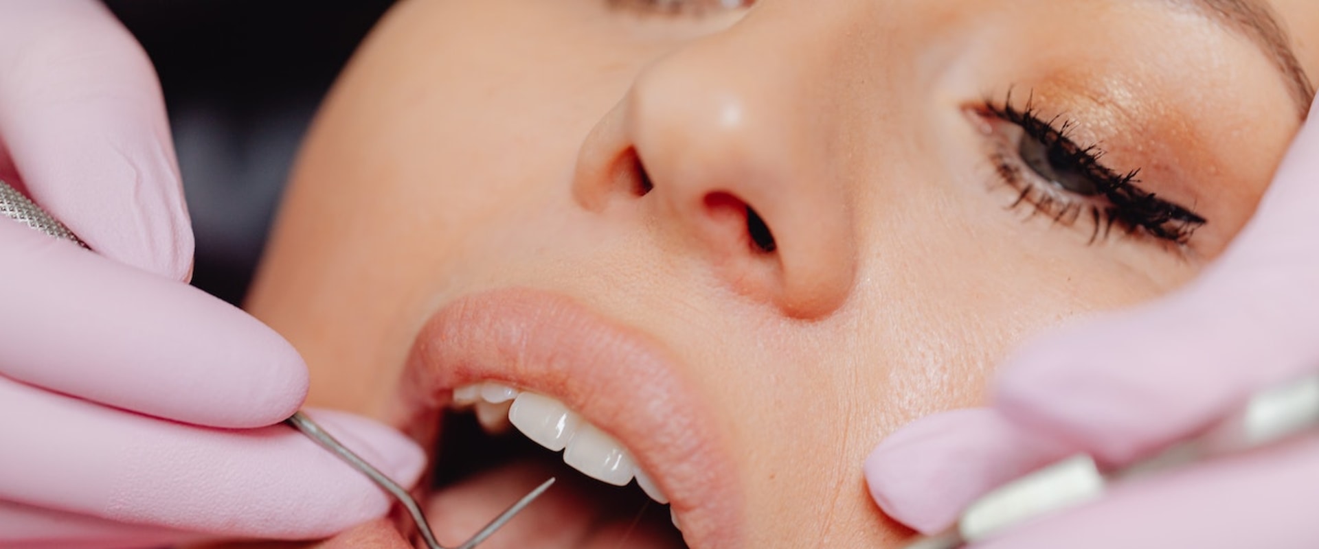 Maintaining Healthy Smiles: The Importance Of General Dentistry In Hillsboro