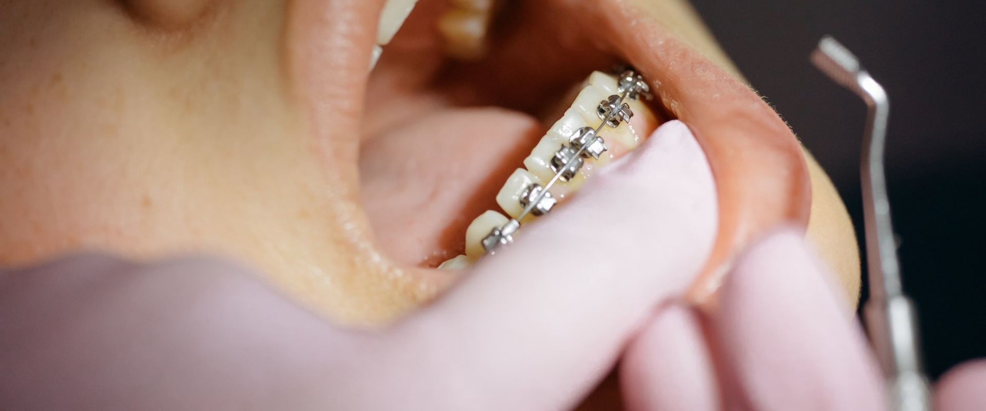 Say Goodbye To Dental Anxiety: A Guide To General Dentistry In Conroe, Texas