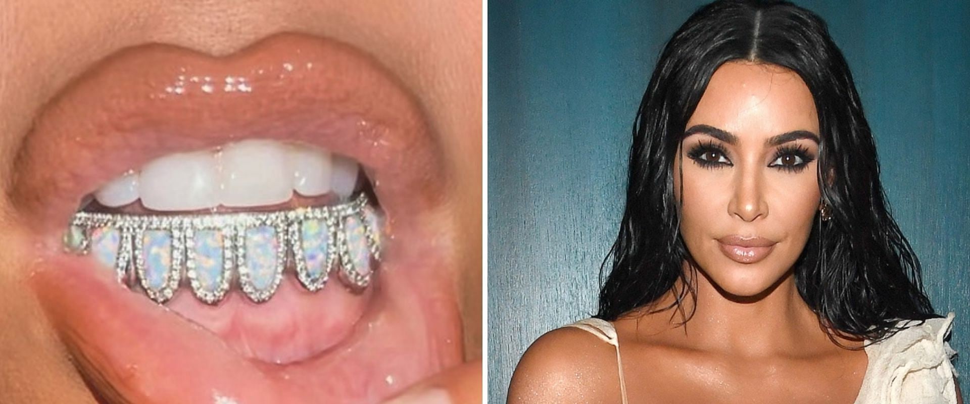 What has kim kardashian done to her teeth?