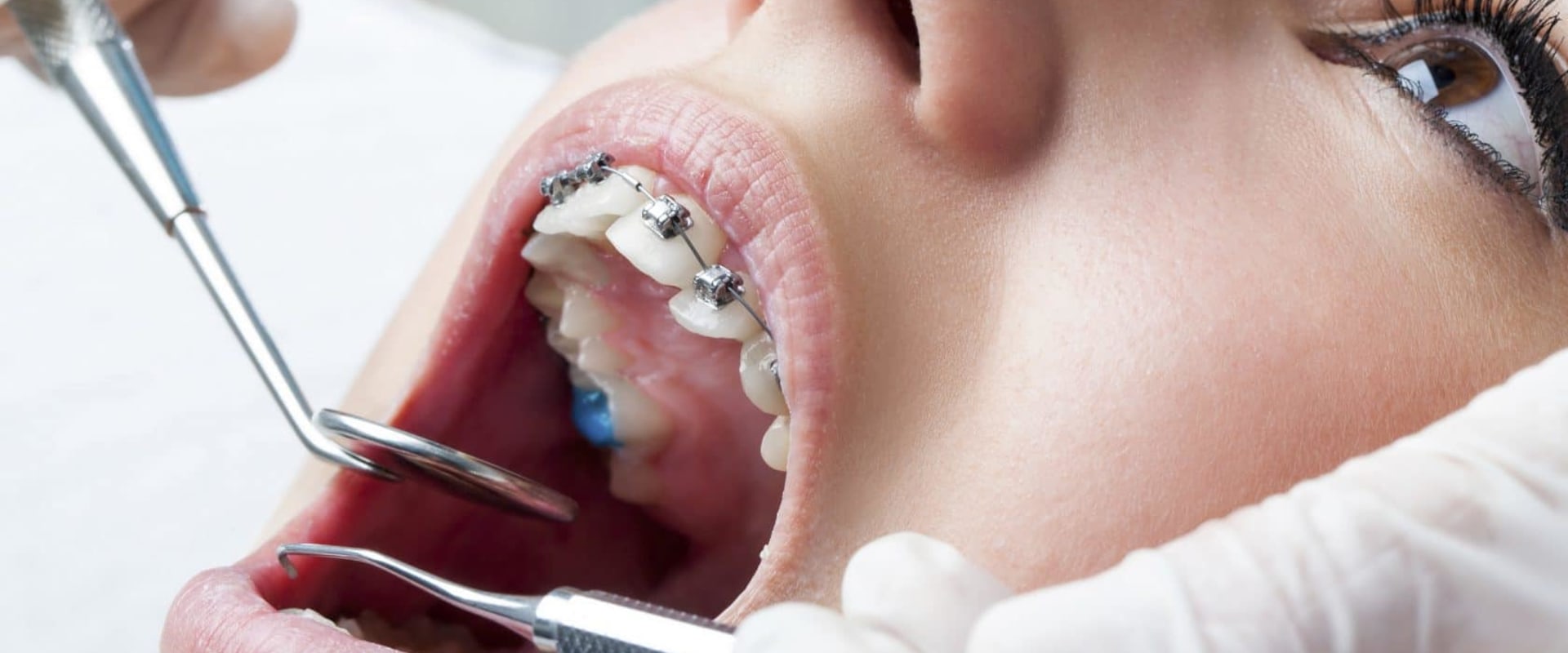 General Dentistry In Spring Branch: How To Properly Care For Your Teeth