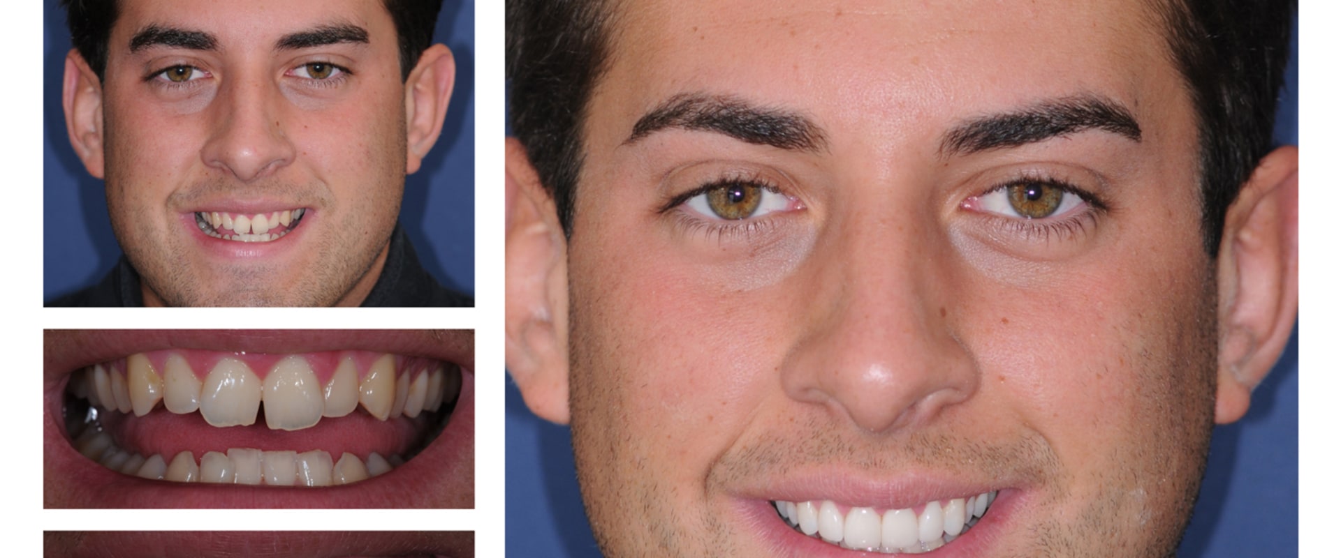 What is an example of cosmetic dentistry?