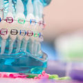 What are orthodontics examples?
