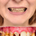 How do you make your teeth look perfect?