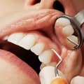 What are the different types of cosmetic dentistry?