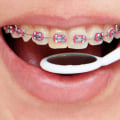 What are the types of orthodontic treatment?