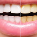 What is cosmetic dentistry treatment?