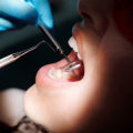 Protecting Your Smile: The Role Of General Dentistry In Managing Gum Disease In Sydney