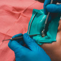 General Dentistry In London: What You Need To Know About Invisible Dental Fillings