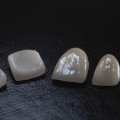 How General Dentistry Can Help Maintain Your Porcelain Veneers In Georgetown