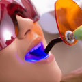 How long do cosmetic fillings last?