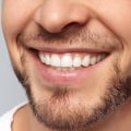 General Dentistry: All You Need To Know About Dental Implants In Beverly Hills, CA