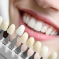 What are the best teeth restoration?