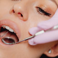 Maintaining Healthy Smiles: The Importance Of General Dentistry In Hillsboro