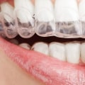 What comes under dental cosmetics?