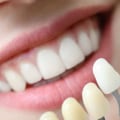 What is involved in cosmetic dentistry?