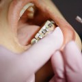 Say Goodbye To Dental Anxiety: A Guide To General Dentistry In Conroe, Texas
