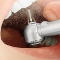 How many types of dental restoration are there?