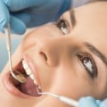 Discovering Exceptional Oral Health Care With General Dentistry In Dripping Springs