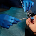 Comprehensive Dental Care In Woden: The Importance Of General Dentistry