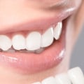 What is included in cosmetic dentistry?