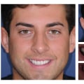 What is an example of cosmetic dentistry?
