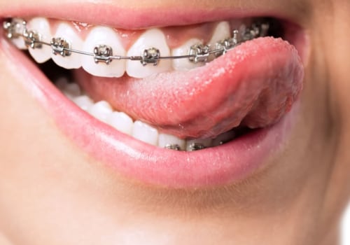 What is orthodontia used for?