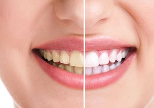 Elevate Your Oral Health with Radiant Dentistry