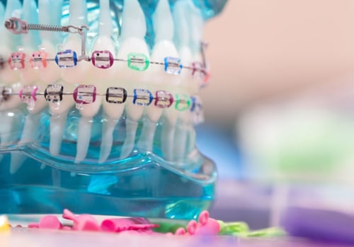 What are orthodontics examples?