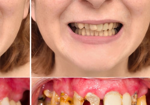 How do you make your teeth look perfect?