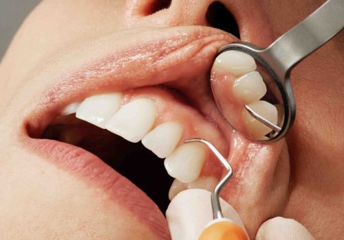 What are the different types of cosmetic dentistry?