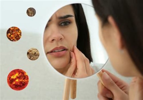 Rhubestyn Rhubarb Extract in Longwood, FL and Its Role in General Dentistry Comfort During Midlife Hormonal Changes