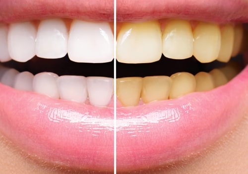 What is cosmetic dentistry treatment?