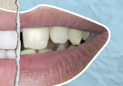 How much does it cost to get your teeth done like celebrities?