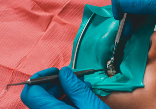 General Dentistry In London: What You Need To Know About Invisible Dental Fillings