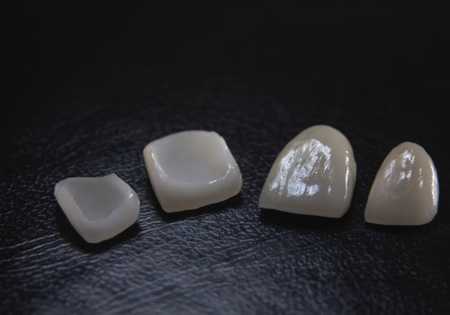 How General Dentistry Can Help Maintain Your Porcelain Veneers In Georgetown