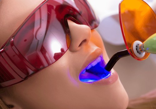 How long do cosmetic fillings last?