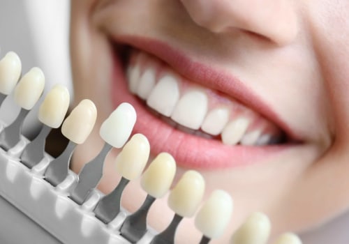 What are the best teeth restoration?
