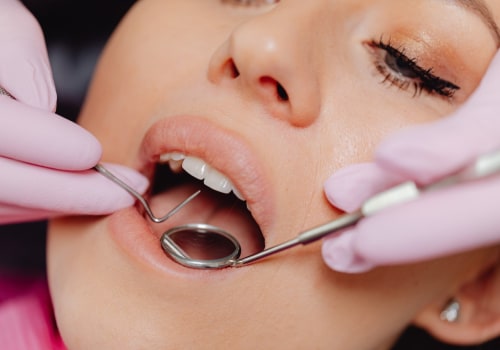 Maintaining Healthy Smiles: The Importance Of General Dentistry In Hillsboro