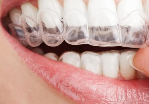 What comes under dental cosmetics?