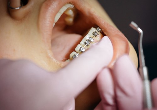 Say Goodbye To Dental Anxiety: A Guide To General Dentistry In Conroe, Texas