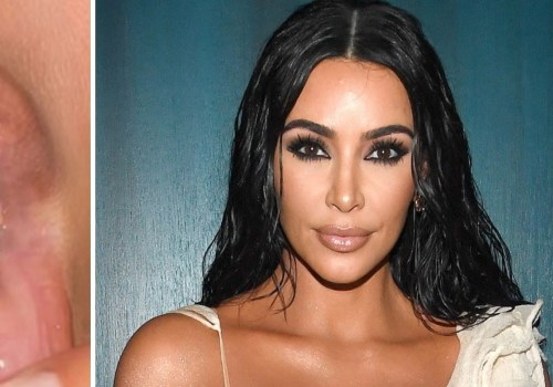 What has kim kardashian done to her teeth?
